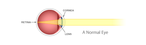 Cornea